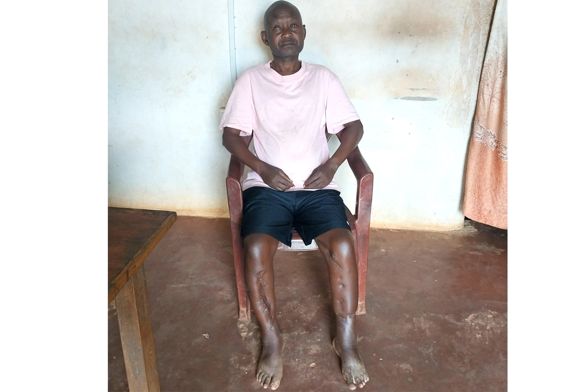 TABASAMU BEFORE WHEEL CHAIR SUPPORT